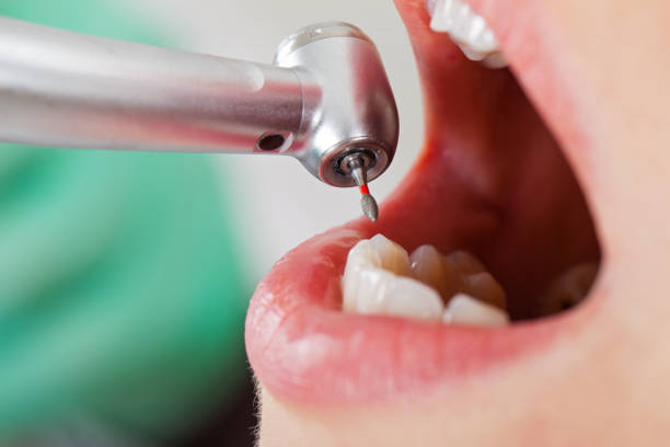 Best Emergency Treatment for Oral Infections in Charlevoix, MI